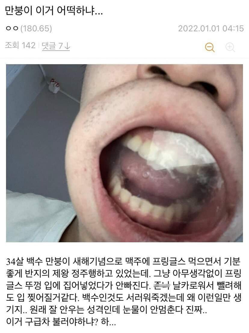 프링글스 뚜껑 입에낀 디씨인