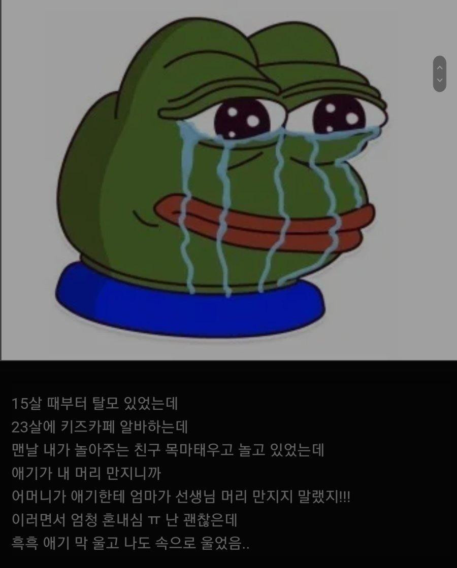 탈모여서 힘들었던 경험