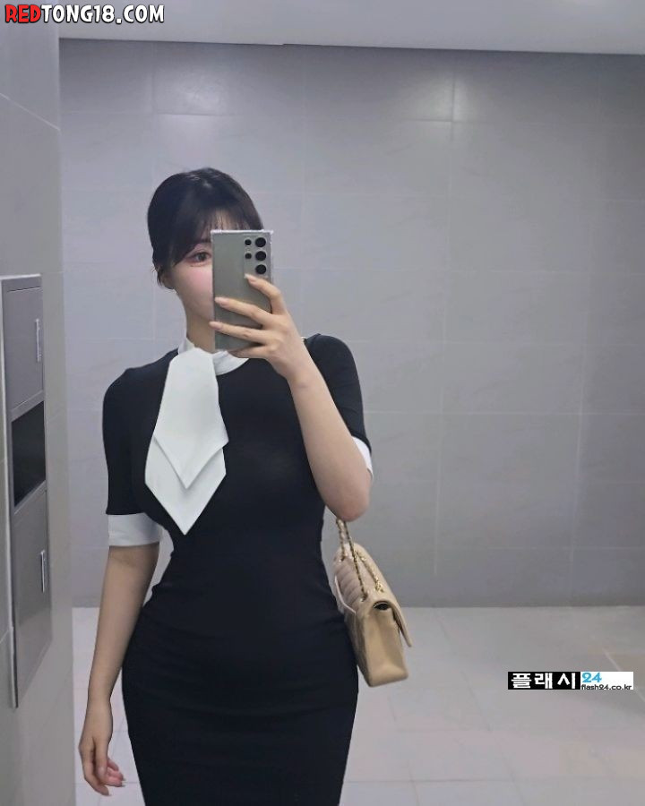 빡쳐서 골반수술 안 했다고 인증하는 누나